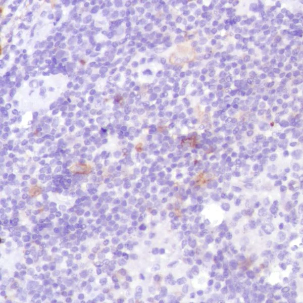 Immunohistochemistry (Formalin/PFA-fixed paraffin-embedded sections) - Anti-CD13 antibody [SP187] (AB227663)