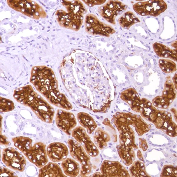 Immunohistochemistry (Formalin/PFA-fixed paraffin-embedded sections) - Anti-CD13 antibody [SP187] (AB227663)