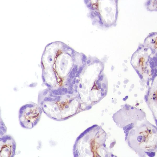 Immunohistochemistry (Formalin/PFA-fixed paraffin-embedded sections) - Anti-CD13 antibody [SP187] (AB227663)