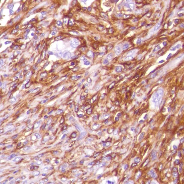 Immunohistochemistry (Formalin/PFA-fixed paraffin-embedded sections) - Anti-CD13 antibody [SP187] (AB227663)