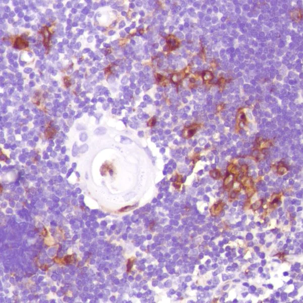 Immunohistochemistry (Formalin/PFA-fixed paraffin-embedded sections) - Anti-CD13 antibody [SP187] (AB227663)