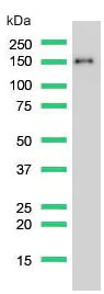 Western blot - Anti-CD13 antibody [SP187] (AB227663)