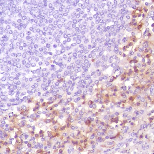 Immunohistochemistry (Formalin/PFA-fixed paraffin-embedded sections) - Anti-CD13 antibody [SP187] - BSA and Azide free (AB245741)