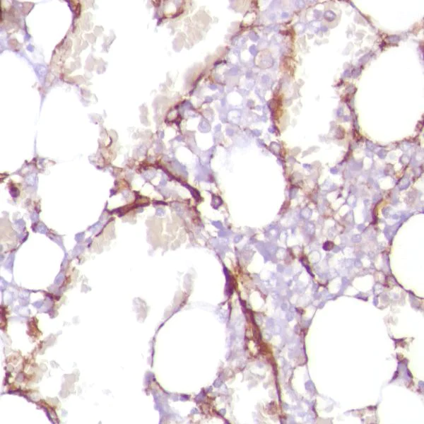 Immunohistochemistry (Formalin/PFA-fixed paraffin-embedded sections) - Anti-CD13 antibody [SP187] - BSA and Azide free (AB245741)