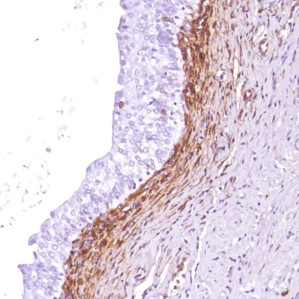 Immunohistochemistry (Formalin/PFA-fixed paraffin-embedded sections) - Anti-CD13 antibody [SP187] - BSA and Azide free (AB245741)