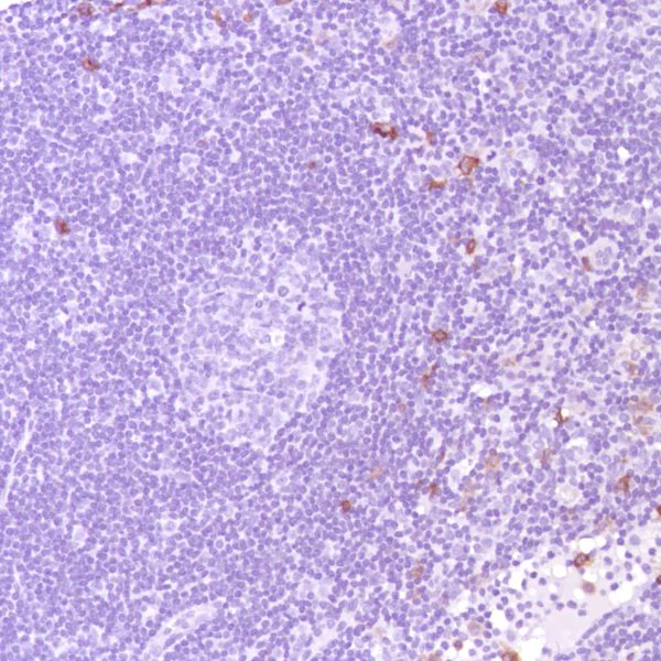 Immunohistochemistry (Formalin/PFA-fixed paraffin-embedded sections) - Anti-CD13 antibody [SP187] - BSA and Azide free (AB245741)