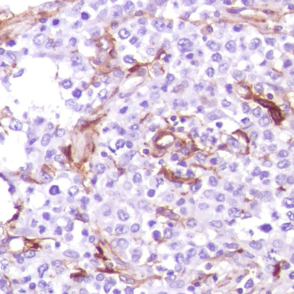 Immunohistochemistry (Formalin/PFA-fixed paraffin-embedded sections) - Anti-CD13 antibody [SP187] - BSA and Azide free (AB245741)
