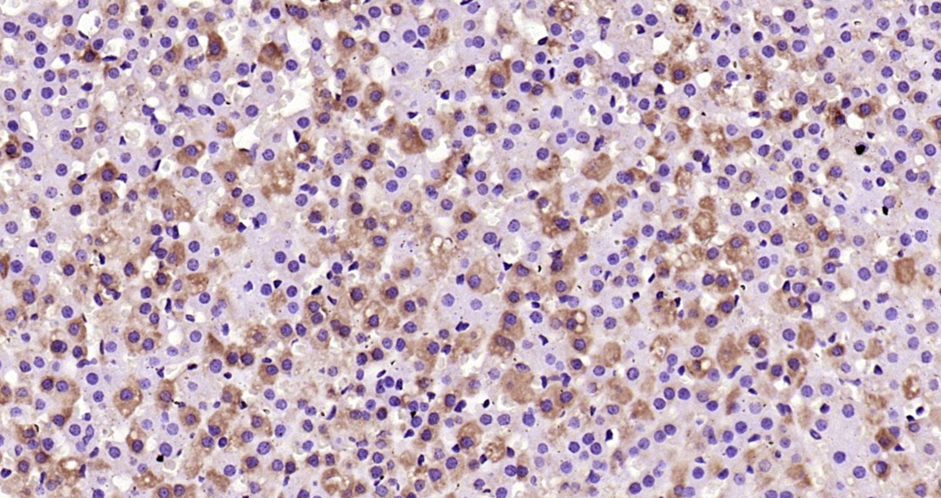 Immunohistochemistry (Formalin/PFA-fixed paraffin-embedded sections) - Anti-CD130 (gp130) antibody (AB202850), expandable thumbnail