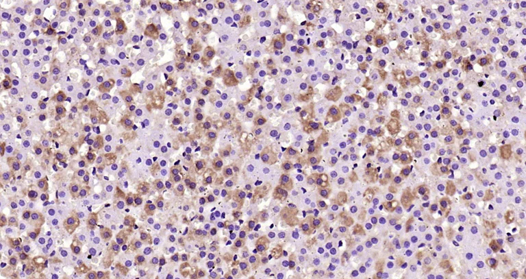 Immunohistochemistry (Formalin/PFA-fixed paraffin-embedded sections) - Anti-CD130 (gp130) antibody (AB202850)