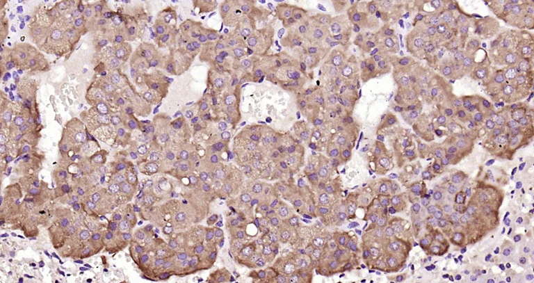 Immunohistochemistry (Formalin/PFA-fixed paraffin-embedded sections) - Anti-CD130 (gp130) antibody (AB202850)