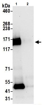 Immunoprecipitation - Anti-CD130 (gp130) antibody - C-terminal (AB226346)