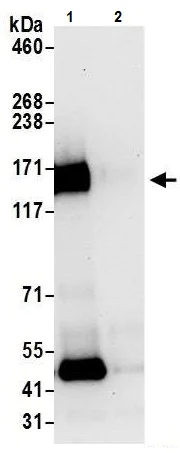 Immunoprecipitation - Anti-CD130 (gp130) antibody - C-terminal (AB226346)