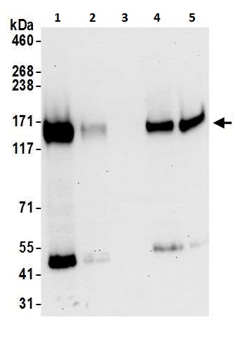 Western blot - Anti-CD130 (gp130) antibody - C-terminal (AB226346)