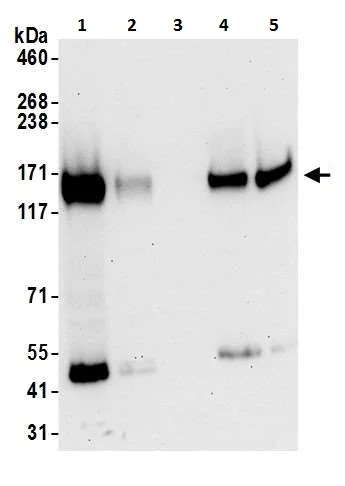 Western blot - Anti-CD130 (gp130) antibody - C-terminal (AB226346)