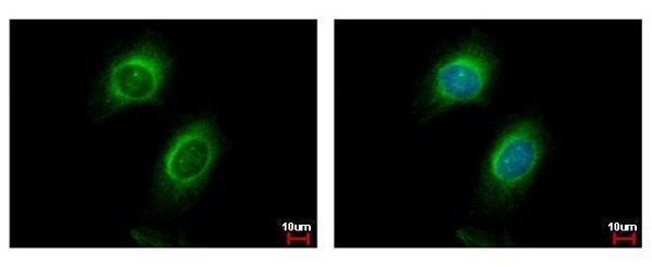 Immunocytochemistry/ Immunofluorescence - Anti-CD130 (gp130) antibody - C-terminal (AB227058)
