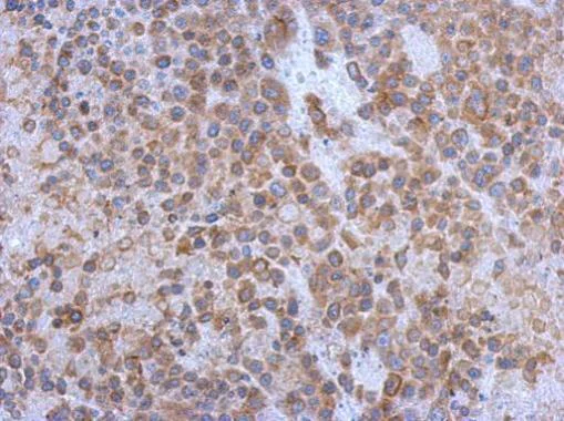 Immunohistochemistry (Formalin/PFA-fixed paraffin-embedded sections) - Anti-CD130 (gp130) antibody - C-terminal (AB227058)