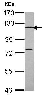 Western blot - Anti-CD130 (gp130) antibody - C-terminal (AB227058)