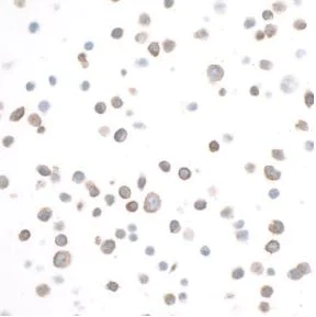 Immunocytochemistry - Anti-CD133 antibody [BLR093G] (AB276130)