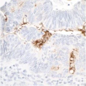 Immunohistochemistry (Formalin/PFA-fixed paraffin-embedded sections) - Anti-CD133 antibody [BLR093G] (AB276130)