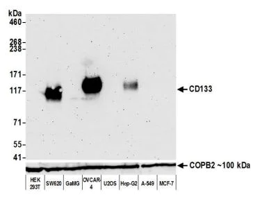 Western blot - Anti-CD133 antibody [BLR093G] (AB276130)