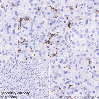 Immunohistochemistry (Formalin/PFA-fixed paraffin-embedded sections) - Anti-CD133 antibody [EPR16508] (AB222782)