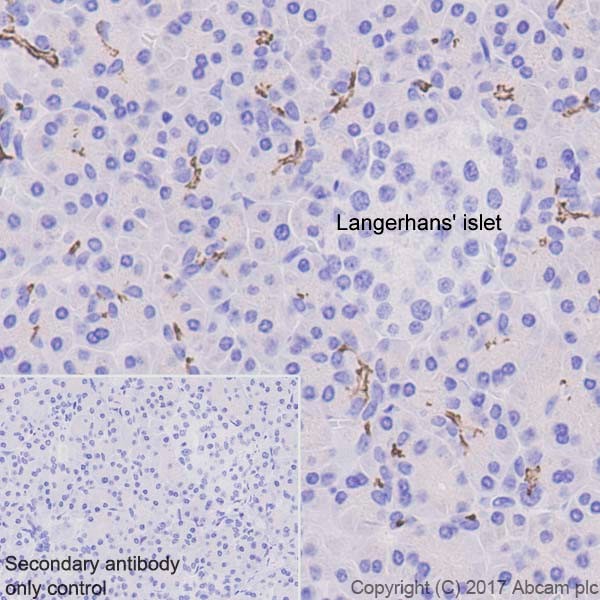 Immunohistochemistry (Formalin/PFA-fixed paraffin-embedded sections) - Anti-CD133 antibody [EPR20980-104] (AB216323), expandable thumbnail