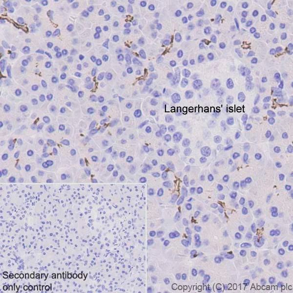 Immunohistochemistry (Formalin/PFA-fixed paraffin-embedded sections) - Anti-CD133 antibody [EPR20980-104] (AB216323)