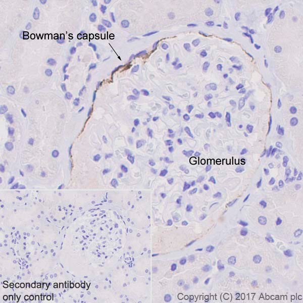Immunohistochemistry (Formalin/PFA-fixed paraffin-embedded sections) - Anti-CD133 antibody [EPR20980-104] (ab216323), expandable thumbnail