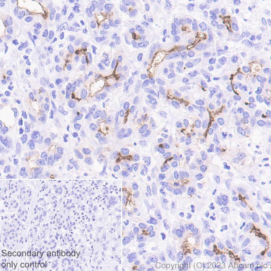 Immunohistochemistry (Formalin/PFA-fixed paraffin-embedded sections) - Anti-CD133 antibody [EPR20980-104] (ab216323), expandable thumbnail