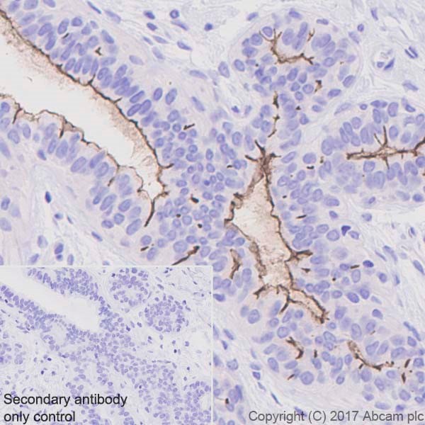 Immunohistochemistry (Formalin/PFA-fixed paraffin-embedded sections) - Anti-CD133 antibody [EPR20980-104] (ab216323), expandable thumbnail