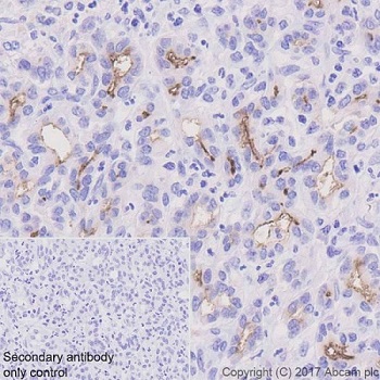 Immunohistochemistry (Formalin/PFA-fixed paraffin-embedded sections) - Anti-CD133 antibody [EPR20980-45] (AB226355), expandable thumbnail