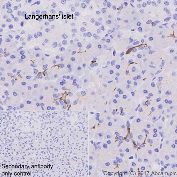 Immunohistochemistry (Formalin/PFA-fixed paraffin-embedded sections) - Anti-CD133 antibody [EPR20980-45] (AB226355), expandable thumbnail
