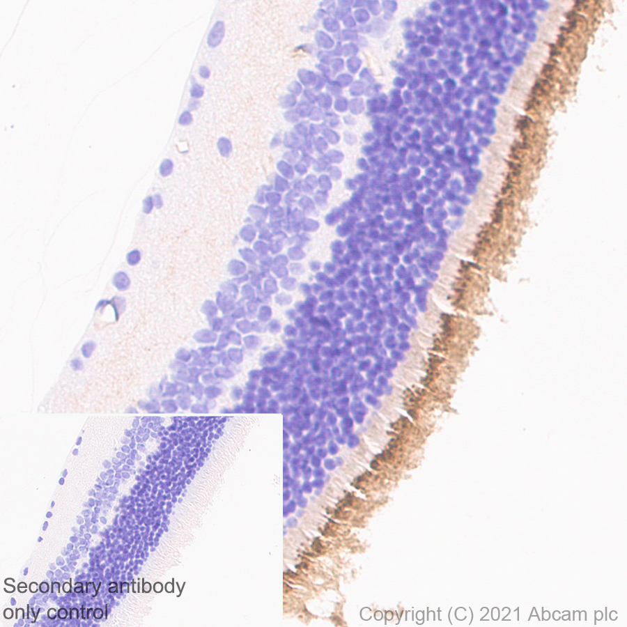 Immunohistochemistry (Formalin/PFA-fixed paraffin-embedded sections) - Anti-CD133 antibody [EPR24348-38] (ab271092), expandable thumbnail