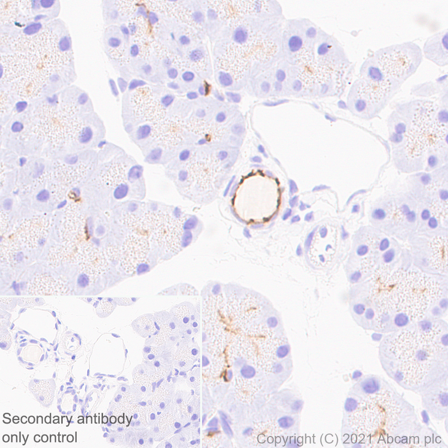 Immunohistochemistry (Formalin/PFA-fixed paraffin-embedded sections) - Anti-CD133 antibody [EPR24348-38] (ab271092), expandable thumbnail