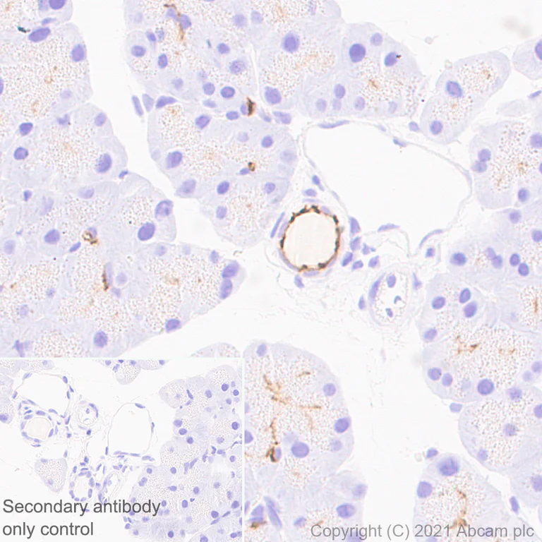 Immunohistochemistry (Formalin/PFA-fixed paraffin-embedded sections) - Anti-CD133 antibody [EPR24348-38] (AB271092)