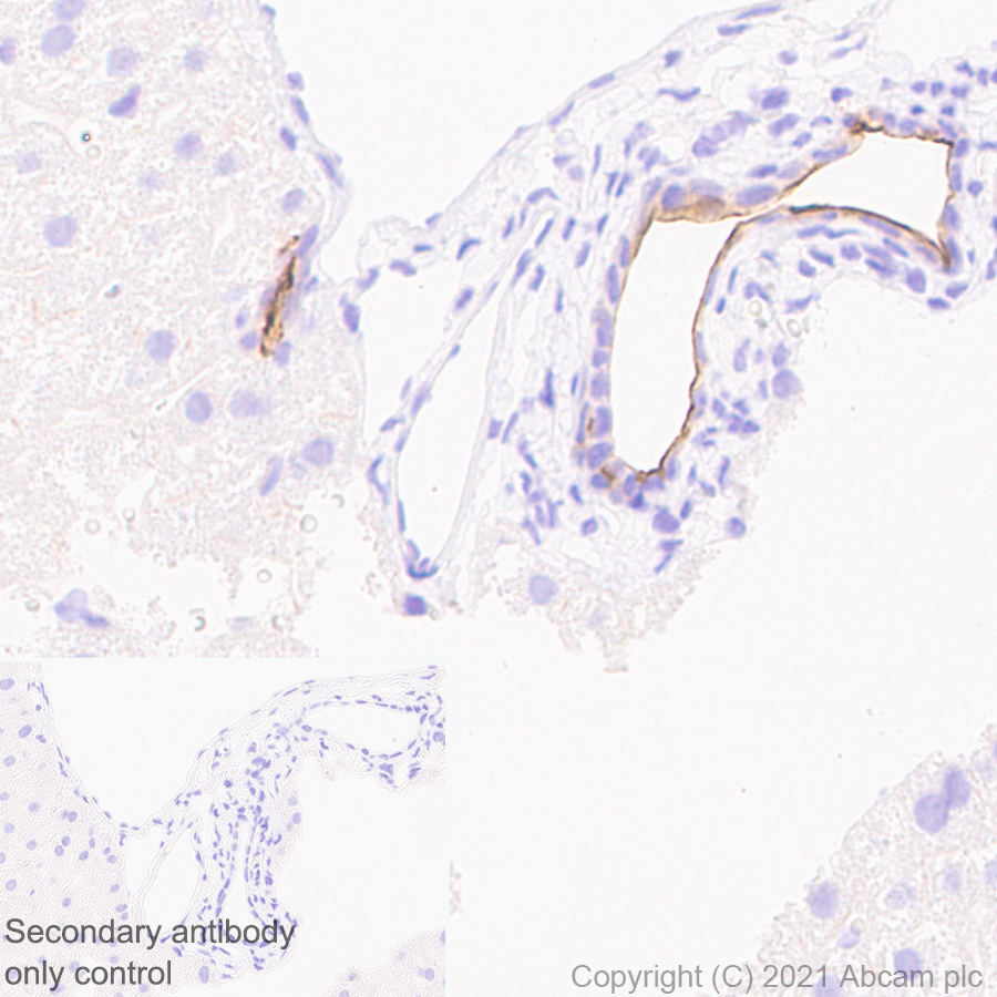 Immunohistochemistry (Formalin/PFA-fixed paraffin-embedded sections) - Anti-CD133 antibody [EPR24348-38] (ab271092), expandable thumbnail