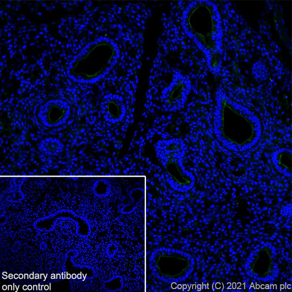 Immunohistochemistry (Frozen sections) - Anti-CD133 antibody [EPR24348-38] (AB271092)