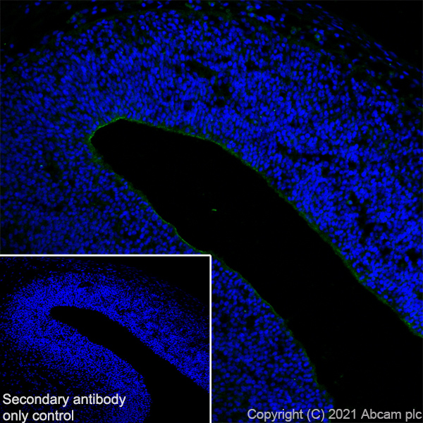 Immunohistochemistry (Frozen sections) - Anti-CD133 antibody [EPR24348-38] (ab271092), expandable thumbnail