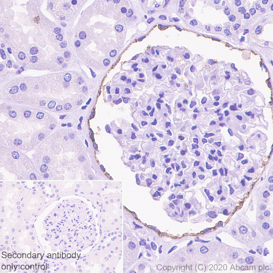 Immunohistochemistry (Formalin/PFA-fixed paraffin-embedded sections) - Anti-CD133 antibody [RM1002] - Stem Cell Marker (ab278053), expandable thumbnail