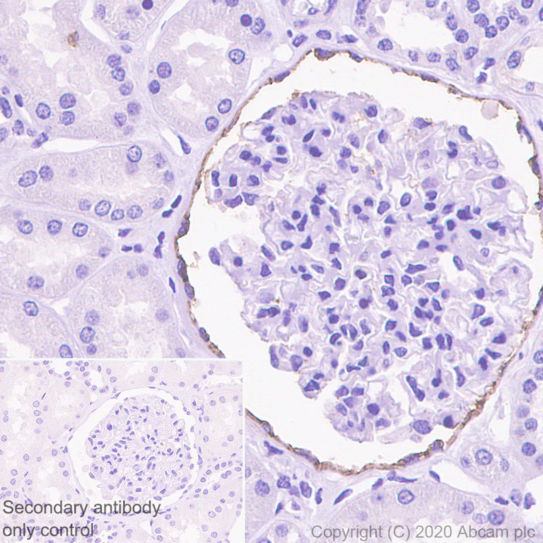 Immunohistochemistry (Formalin/PFA-fixed paraffin-embedded sections) - Anti-CD133 antibody [RM1002] - Stem Cell Marker (AB278053)