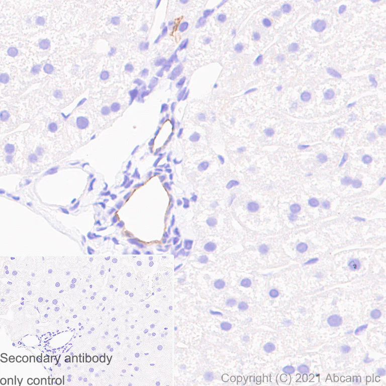 Immunohistochemistry (Formalin/PFA-fixed paraffin-embedded sections) - Anti-CD133 antibody [RM1029] (AB284389)