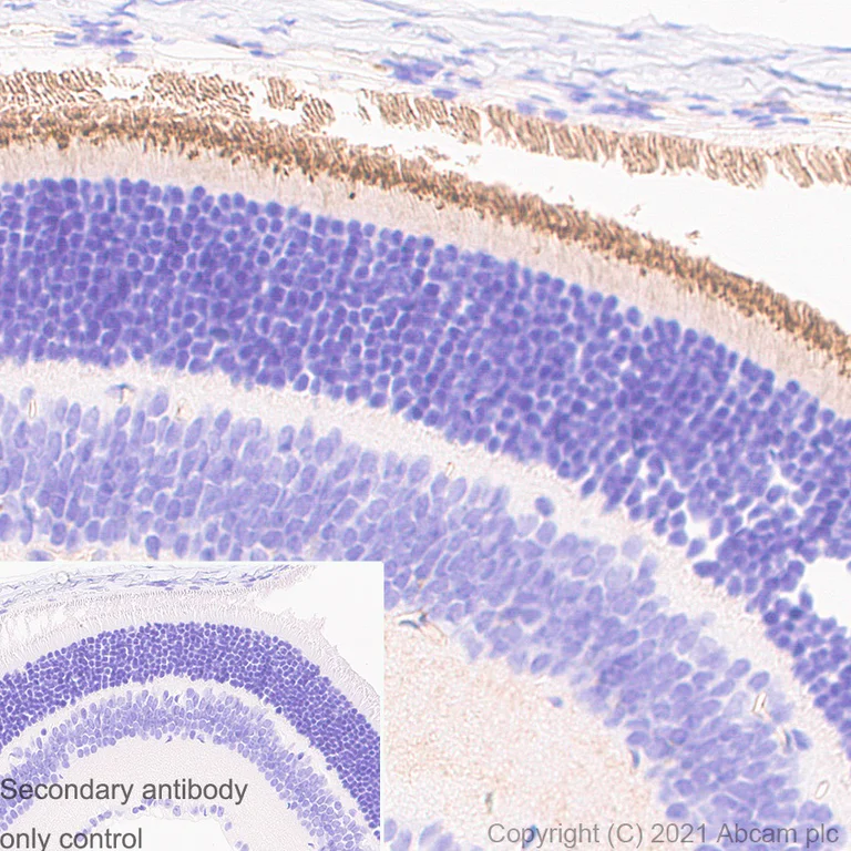 Immunohistochemistry (Formalin/PFA-fixed paraffin-embedded sections) - Anti-CD133 antibody [RM1029] (AB284389)