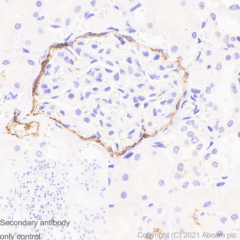 Immunohistochemistry (Formalin/PFA-fixed paraffin-embedded sections) - Anti-CD133 antibody [RM1029] (AB284389)