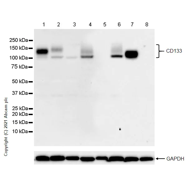 Western blot - Anti-CD133 antibody [RM1029] (AB284389)