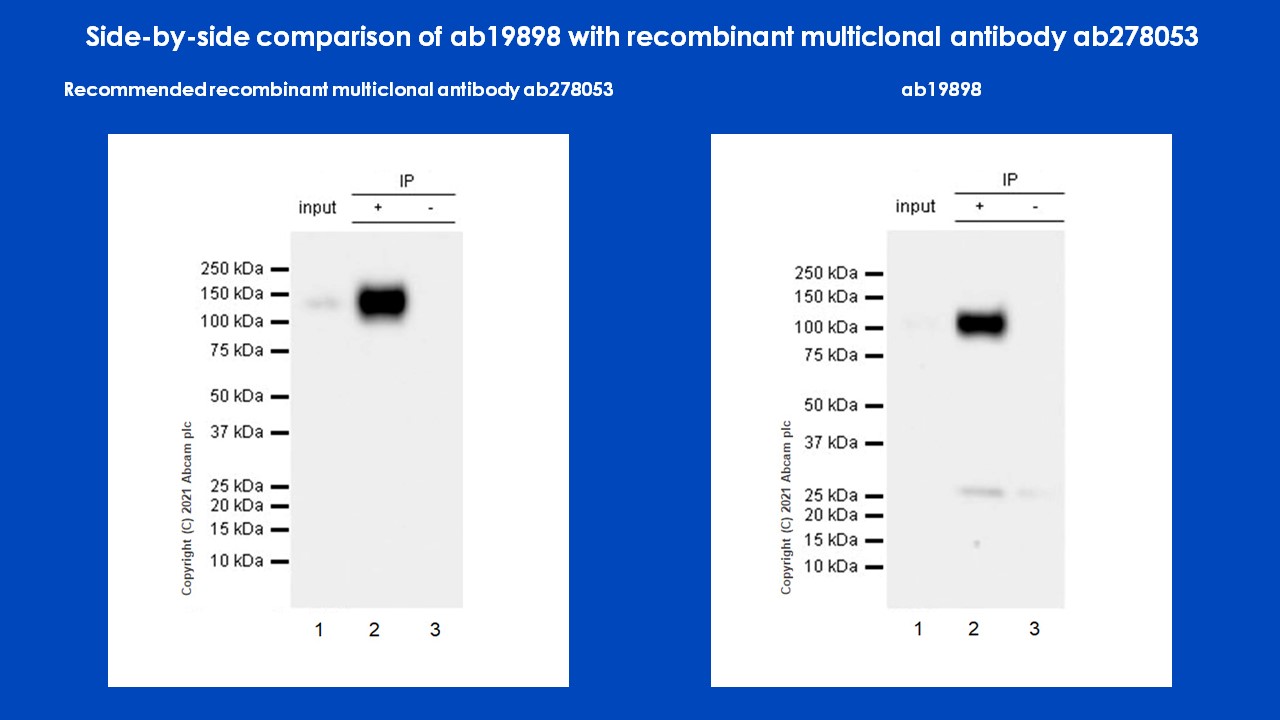 Immunoprecipitation - Anti-CD133 antibody - Stem Cell Marker (AB19898), expandable thumbnail