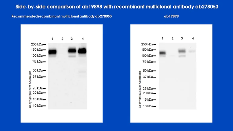 Western blot - Anti-CD133 antibody - Stem Cell Marker (AB19898)