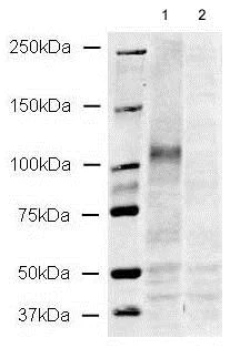 Western blot - Anti-CD133 antibody - Stem Cell Marker (AB19898)
