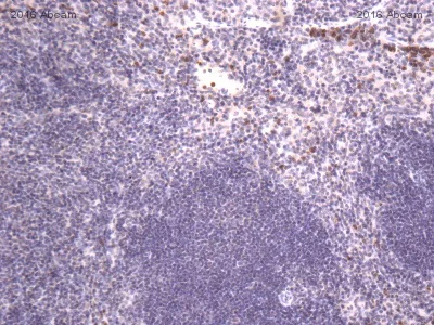 Immunohistochemistry (Formalin/PFA-fixed paraffin-embedded sections) - Anti-CD134 / OX40L receptor antibody (AB203220)