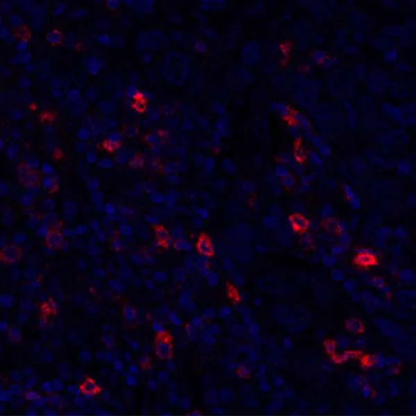 Immunohistochemistry (Formalin/PFA-fixed paraffin-embedded sections) - Anti-CD134 / OX40L receptor antibody [BLR042F] (AB243898)