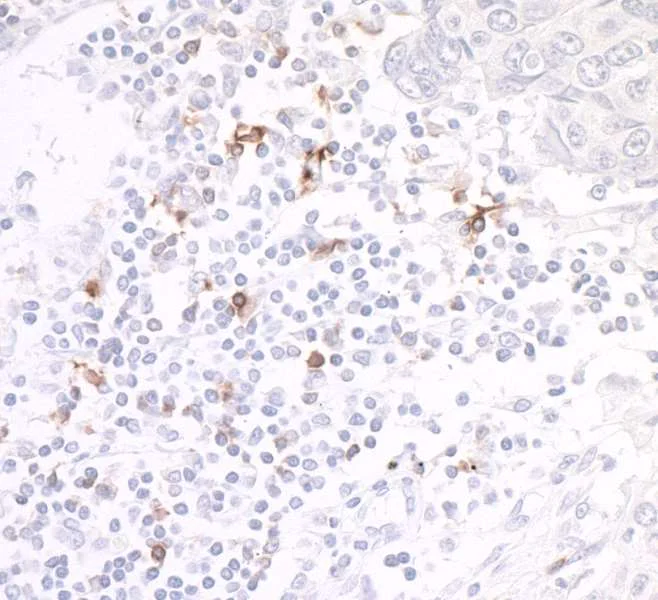 Immunohistochemistry (Formalin/PFA-fixed paraffin-embedded sections) - Anti-CD134 / OX40L receptor antibody [BLR042F] (AB243898)